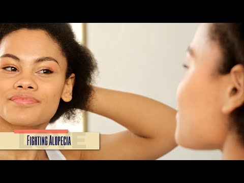 Fighting Alopecia: The Unvarnished Truth